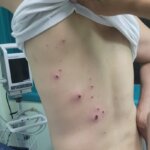 Grave escalation degli attacchi al villaggio di Bardala da parte dei coloni, l’esercito fornisce protezione