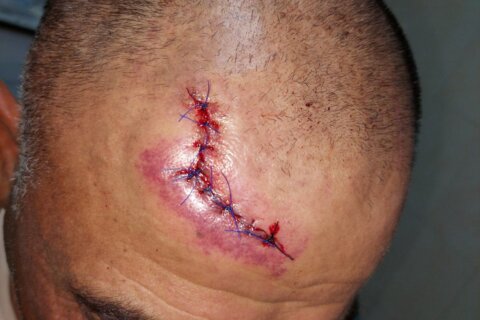 Violent settler attack in Khirbet Humsa