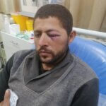 IOF delay ambulance after settler attack