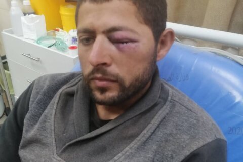 IOF delay ambulance after settler attack